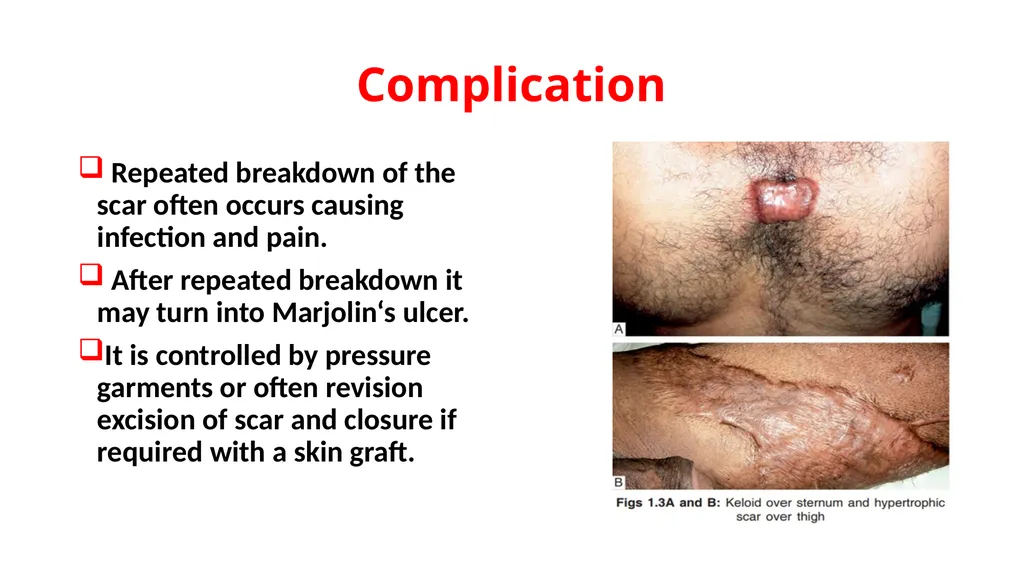 Wound Dr. Muhammad Abdullah Shwani Assistant - slide 17 of 18