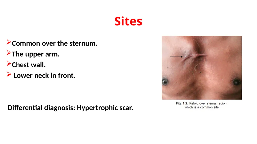 Wound Dr. Muhammad Abdullah Shwani Assistant - slide 14 of 18