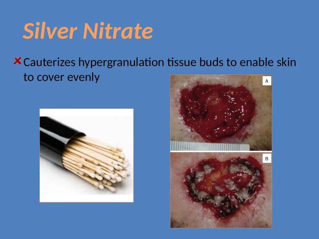 Practical Wound Care Strategies Created by L. - slide 23 of 50