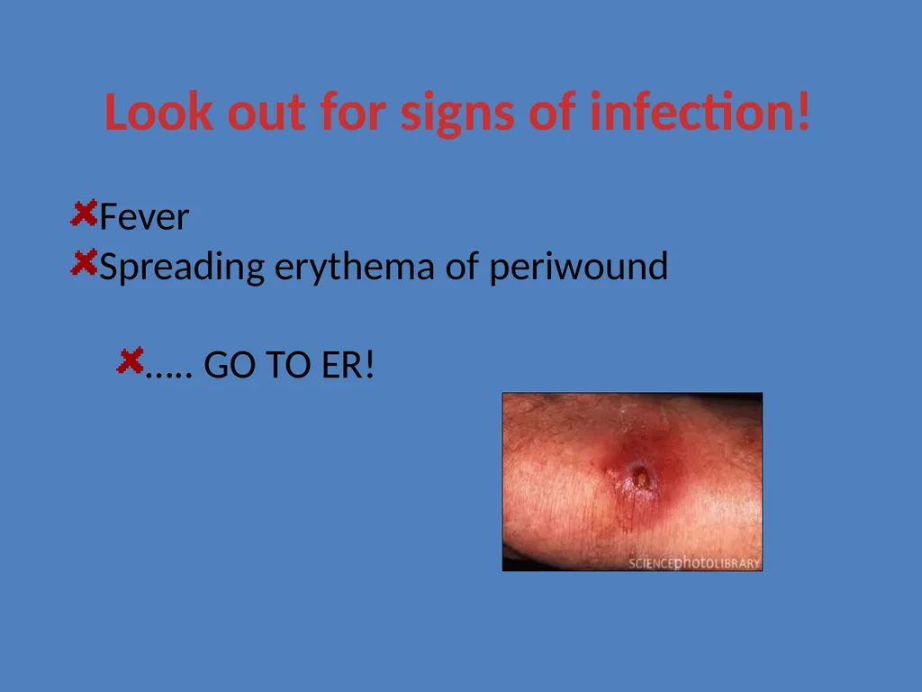 Practical Wound Care Strategies Created by L. - slide 11 of 50