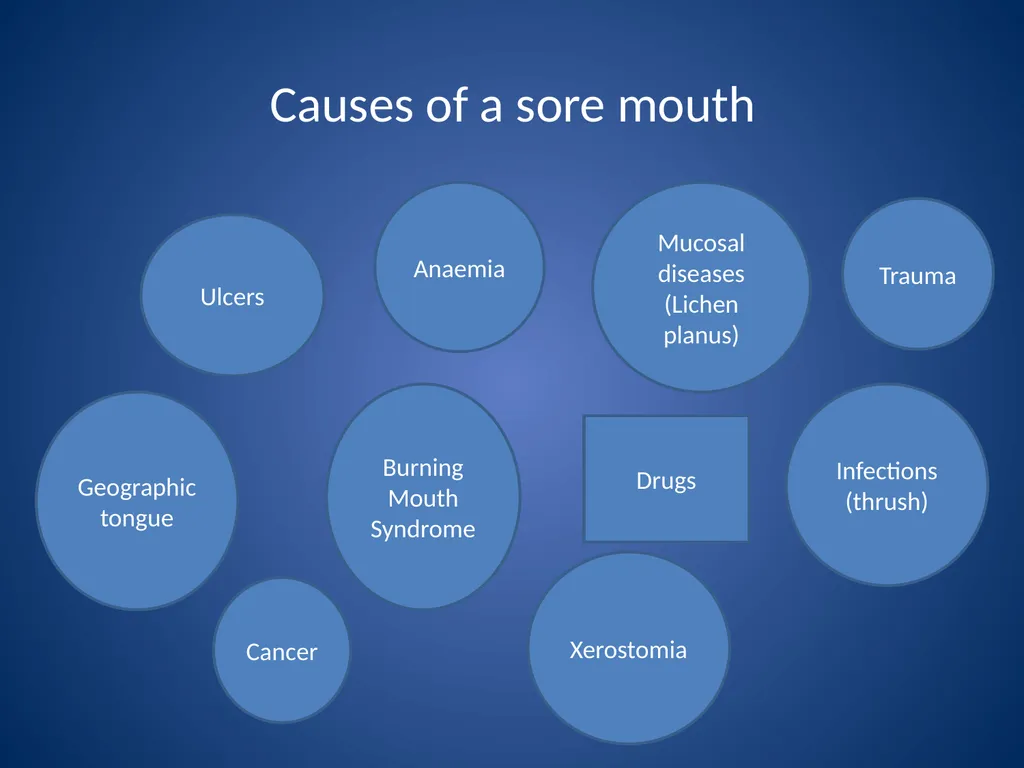 Burning Mouth Syndrome - a frequently unrecognised - slide 2 of 26