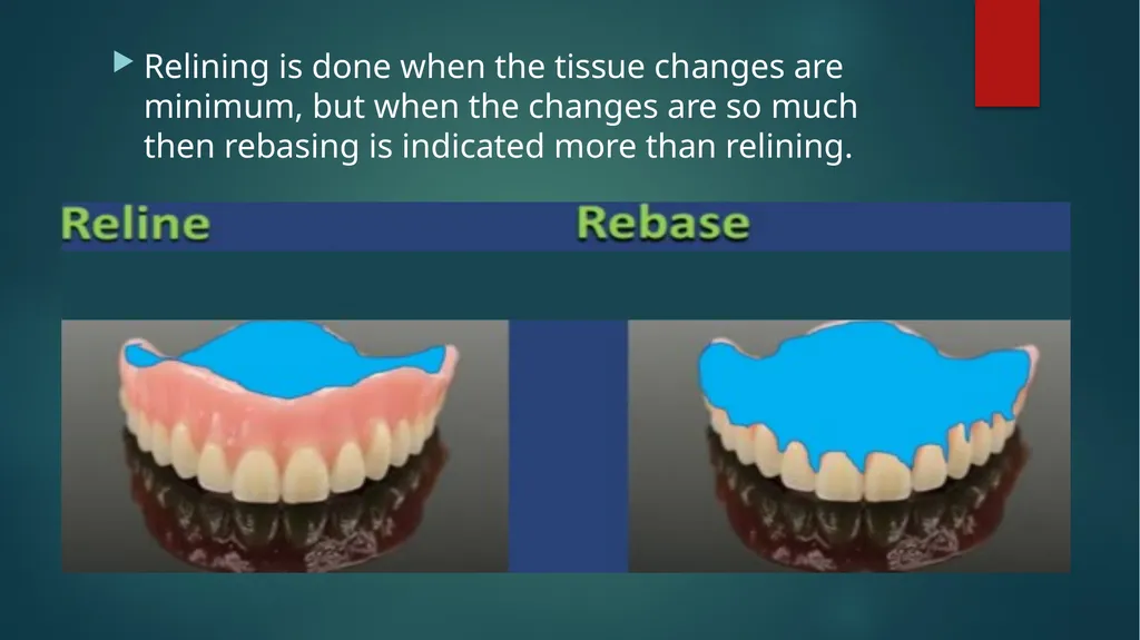 Relining and Rebasing: Relining: It is the - slide 4 of 21