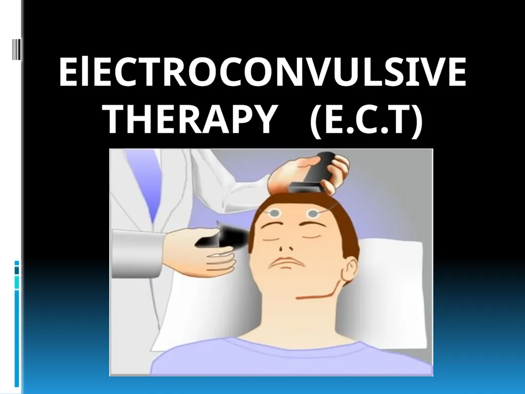 ElECTROCONVULSIVE THERAPY (E.C.T) INTRODUCTION:- - slide 1 of 32