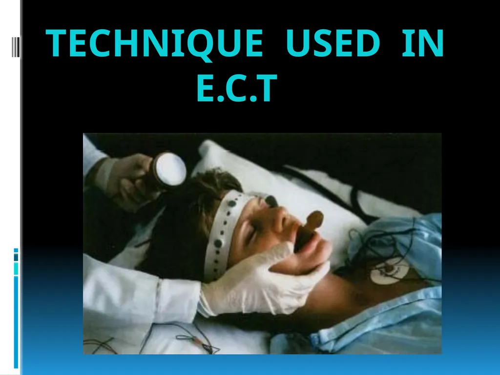 ElECTROCONVULSIVE THERAPY (E.C.T) INTRODUCTION:- - slide 14 of 32