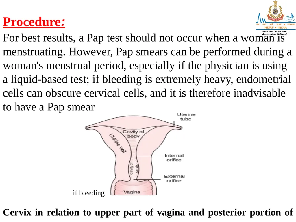 CYTOLOGY LESSON -9 By JITENDER YADAV INSP/PH Upon - slide 8 of 12