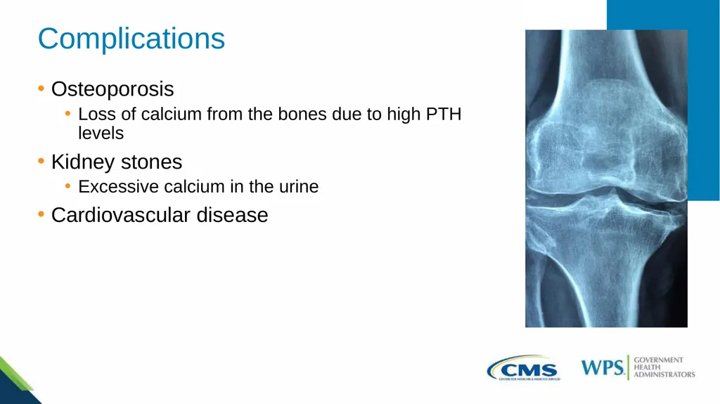 Medicare Preventive Services for Bone Mass - slide 20 of 32