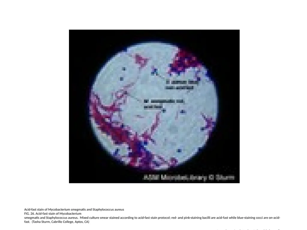 Acid-Fast Stain Author: Multiple Authors Citation: - slide 27 of 27