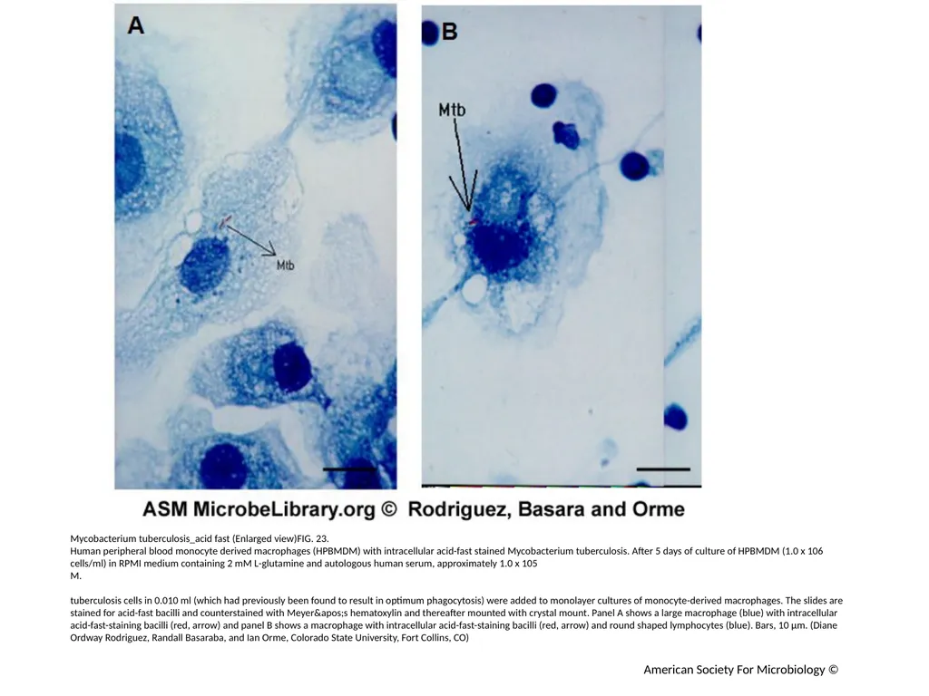 Acid-Fast Stain Author: Multiple Authors Citation: - slide 24 of 27