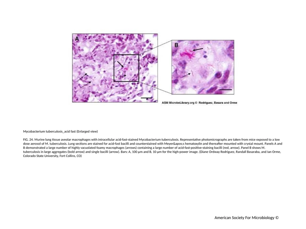 Acid-Fast Stain Author: Multiple Authors Citation: - slide 25 of 27