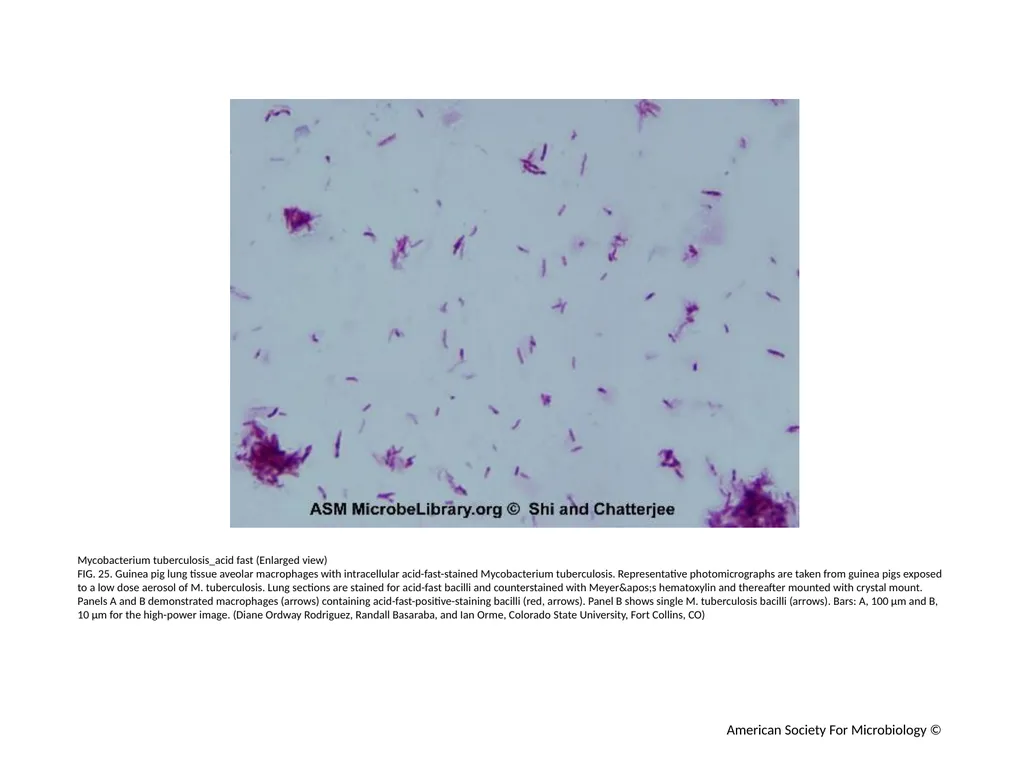 Acid-Fast Stain Author: Multiple Authors Citation: - slide 26 of 27