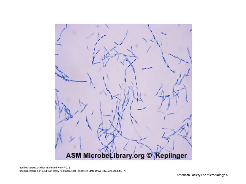 Acid-Fast Stain Author: Multiple Authors Citation: - slide 3 of 27