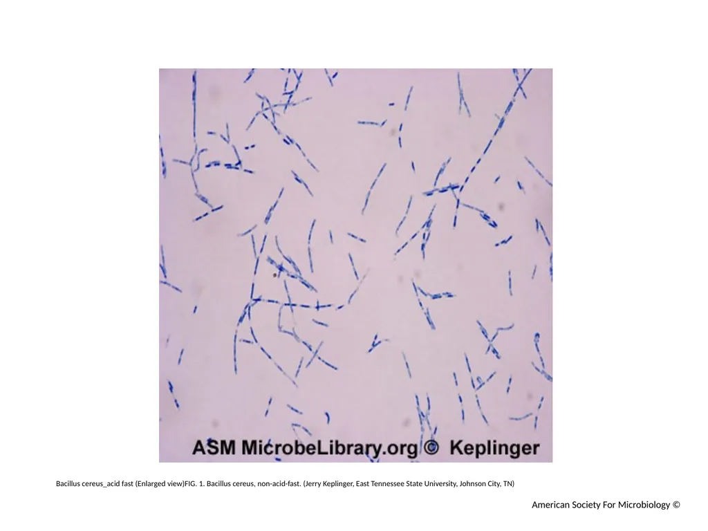 Acid-Fast Stain Author: Multiple Authors Citation: - slide 2 of 27