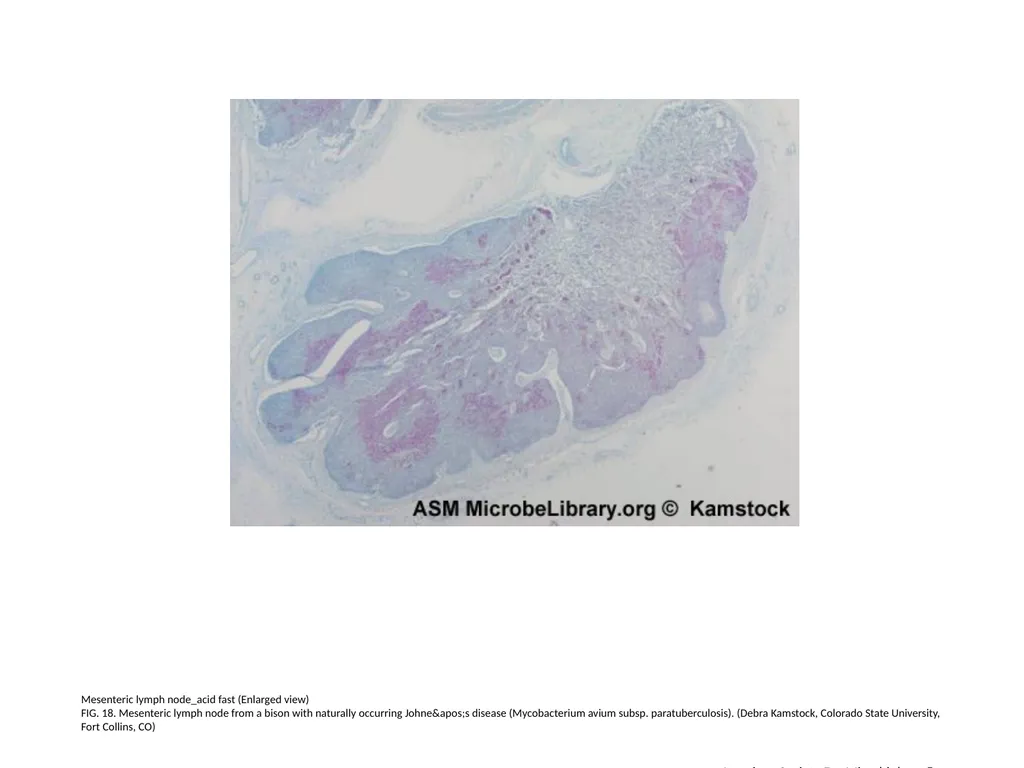 Acid-Fast Stain Author: Multiple Authors Citation: - slide 19 of 27