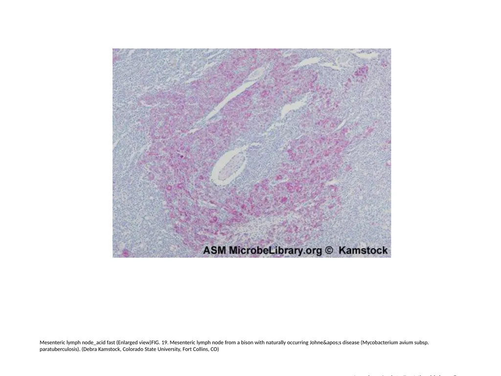 Acid-Fast Stain Author: Multiple Authors Citation: - slide 20 of 27