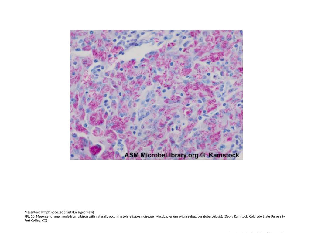 Acid-Fast Stain Author: Multiple Authors Citation: - slide 21 of 27