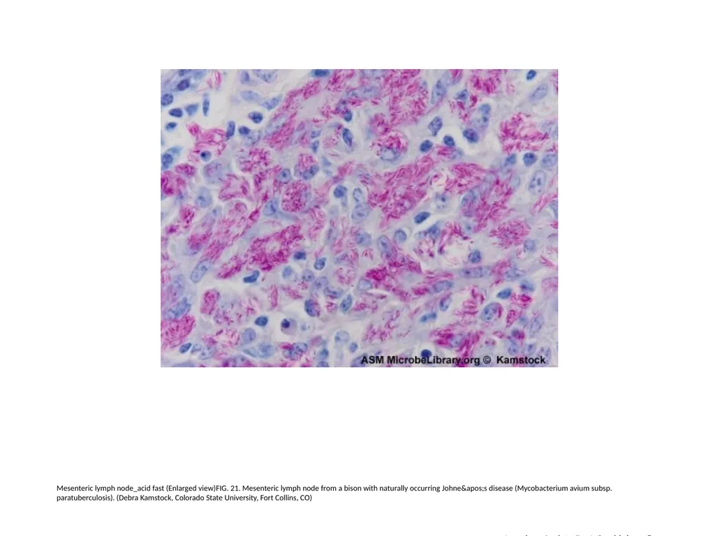 Acid-Fast Stain Author: Multiple Authors Citation: - slide 22 of 27