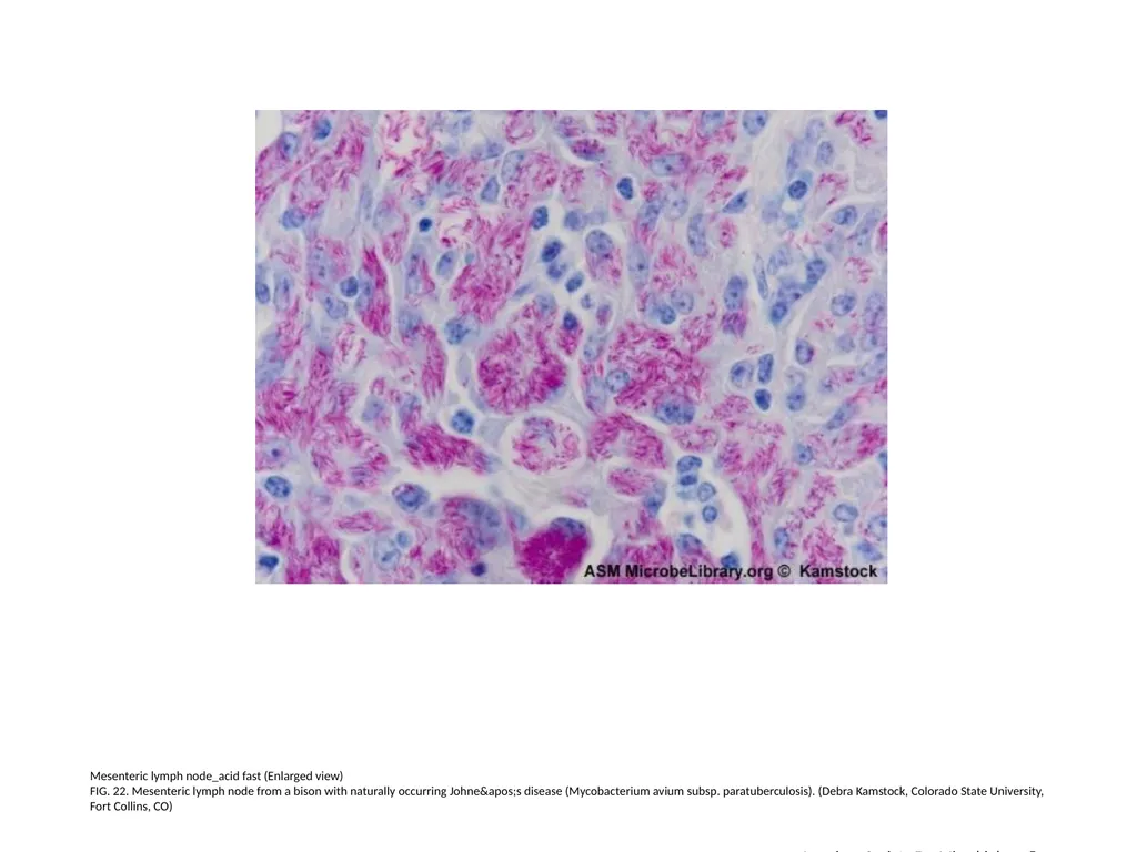 Acid-Fast Stain Author: Multiple Authors Citation: - slide 23 of 27
