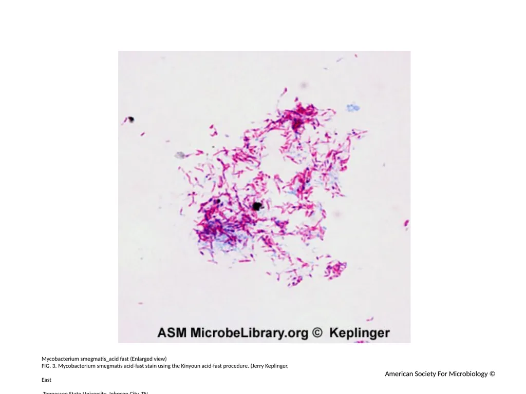 Acid-Fast Stain Author: Multiple Authors Citation: - slide 4 of 27