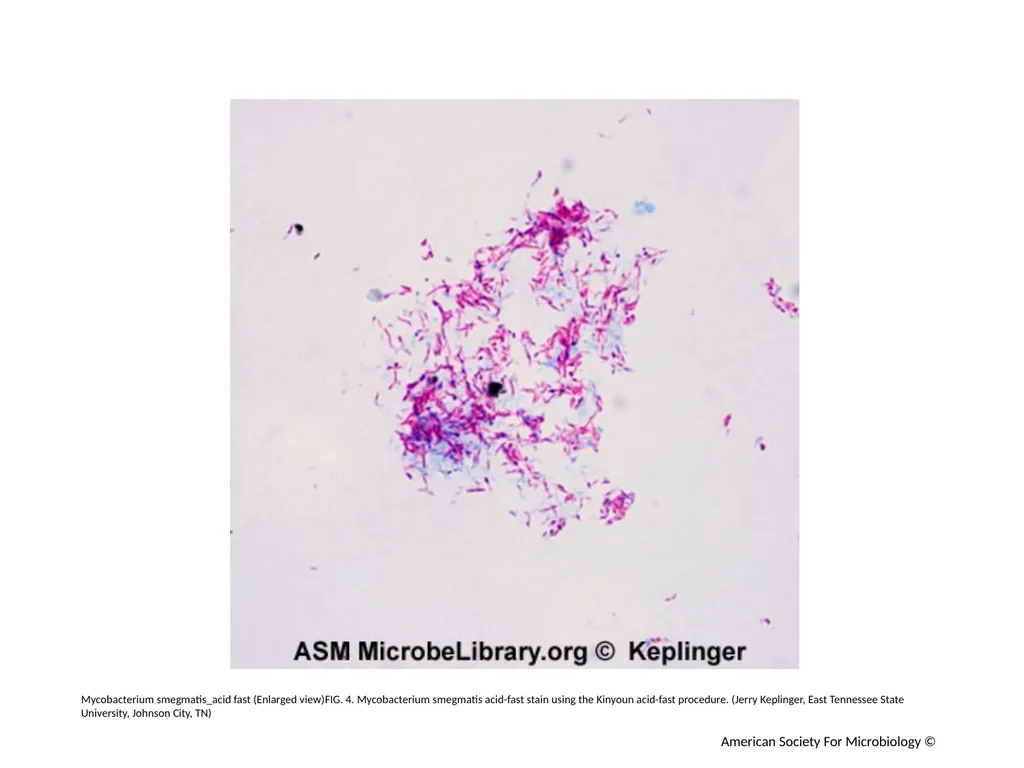 Acid-Fast Stain Author: Multiple Authors Citation: - slide 5 of 27