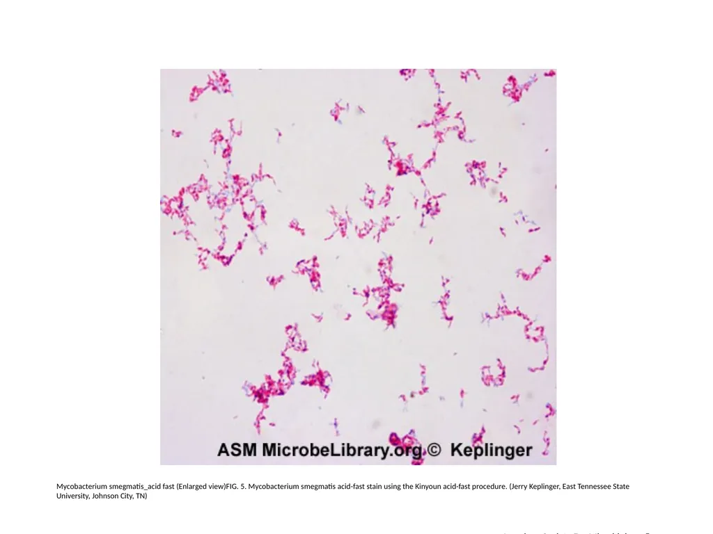 Acid-Fast Stain Author: Multiple Authors Citation: - slide 6 of 27