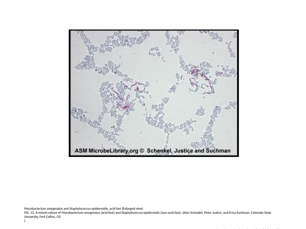 Acid-Fast Stain Author: Multiple Authors Citation: - slide 14 of 27