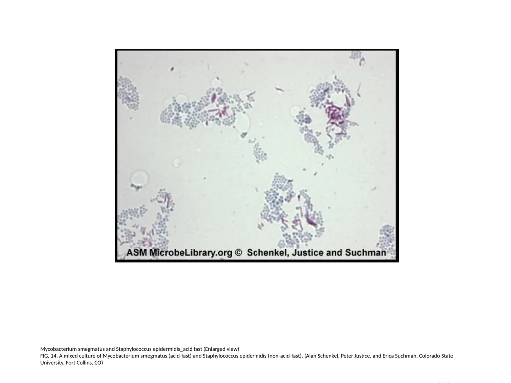 Acid-Fast Stain Author: Multiple Authors Citation: - slide 15 of 27