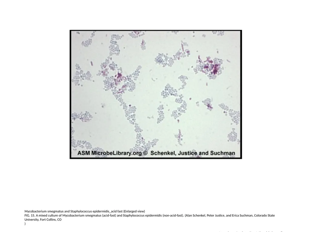 Acid-Fast Stain Author: Multiple Authors Citation: - slide 16 of 27