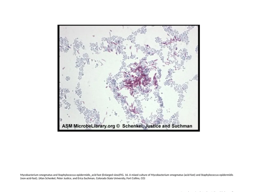 Acid-Fast Stain Author: Multiple Authors Citation: - slide 17 of 27