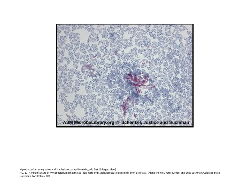 Acid-Fast Stain Author: Multiple Authors Citation: - slide 18 of 27