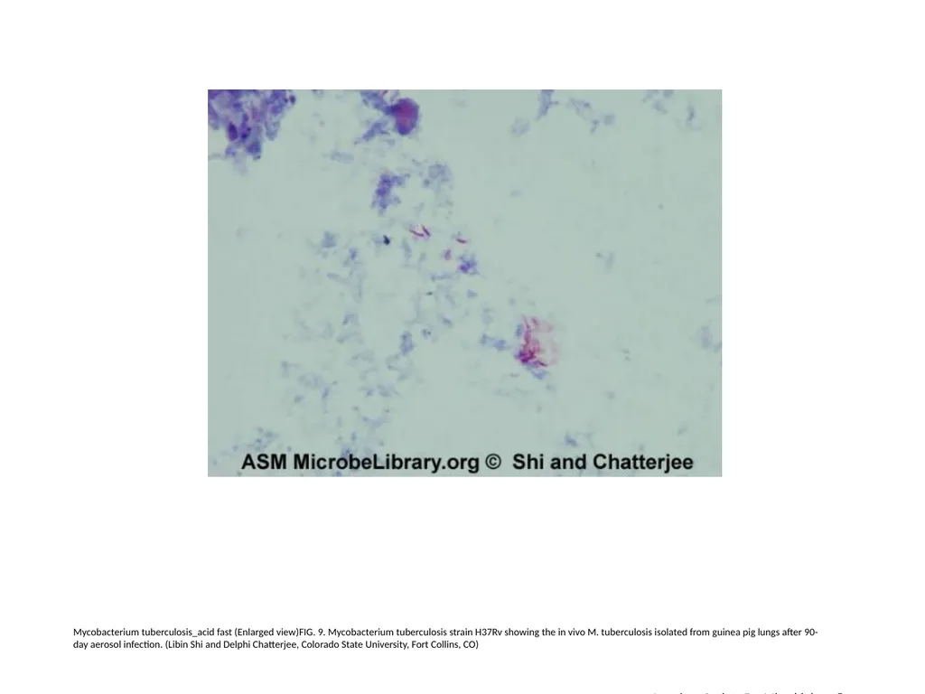 Acid-Fast Stain Author: Multiple Authors Citation: - slide 10 of 27