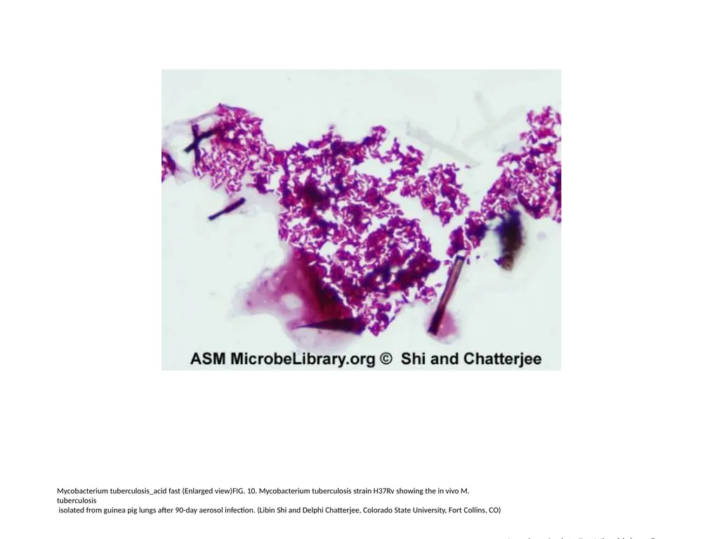 Acid-Fast Stain Author: Multiple Authors Citation: - slide 11 of 27