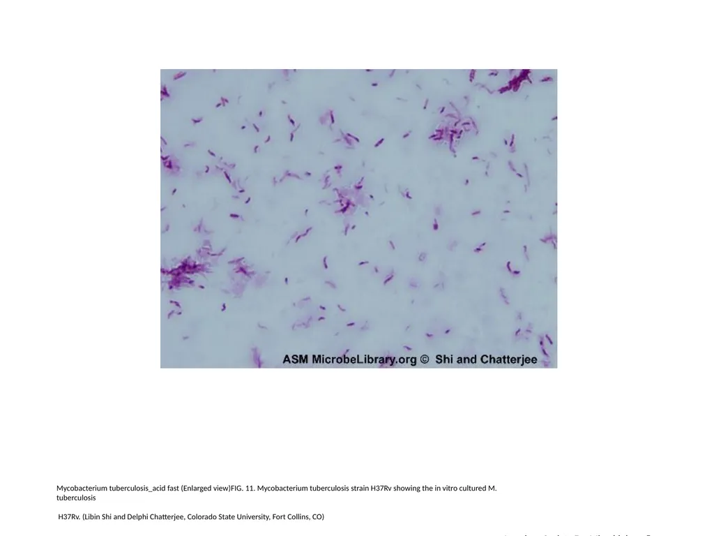 Acid-Fast Stain Author: Multiple Authors Citation: - slide 12 of 27