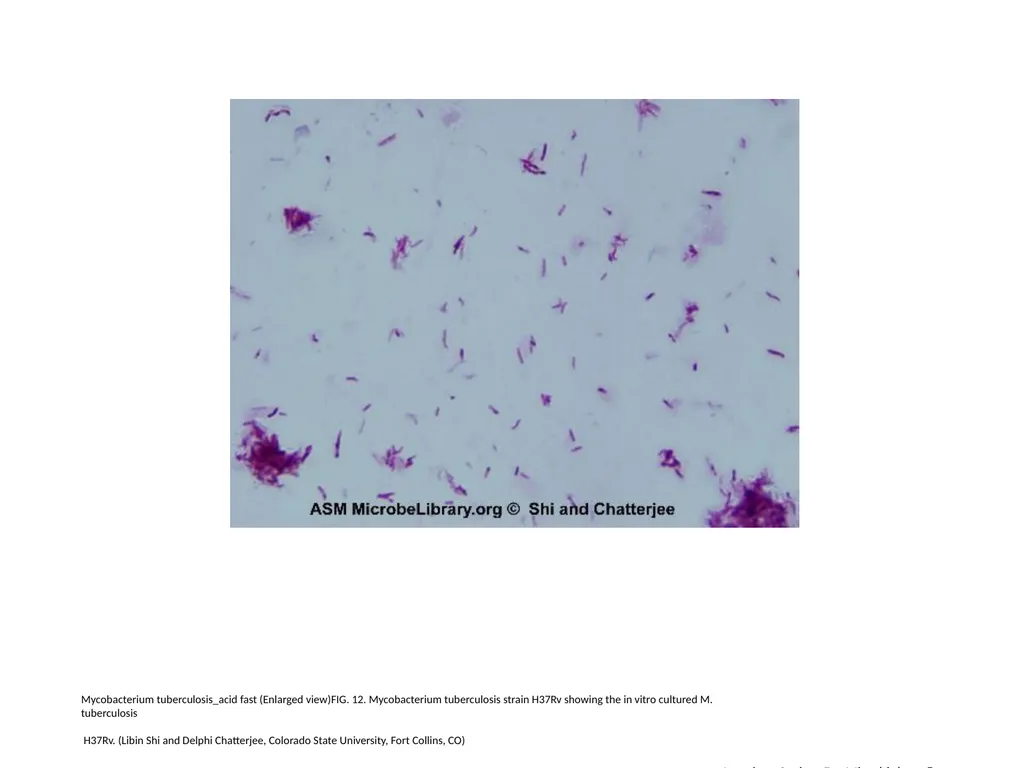 Acid-Fast Stain Author: Multiple Authors Citation: - slide 13 of 27