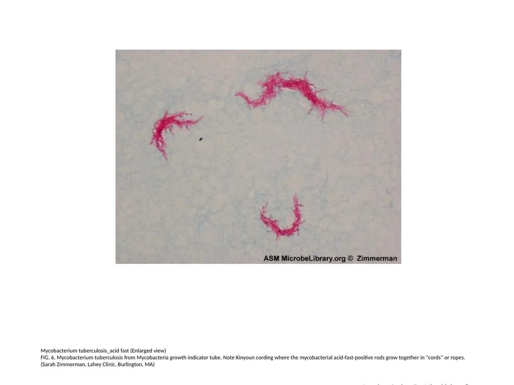 Acid-Fast Stain Author: Multiple Authors Citation: - slide 7 of 27