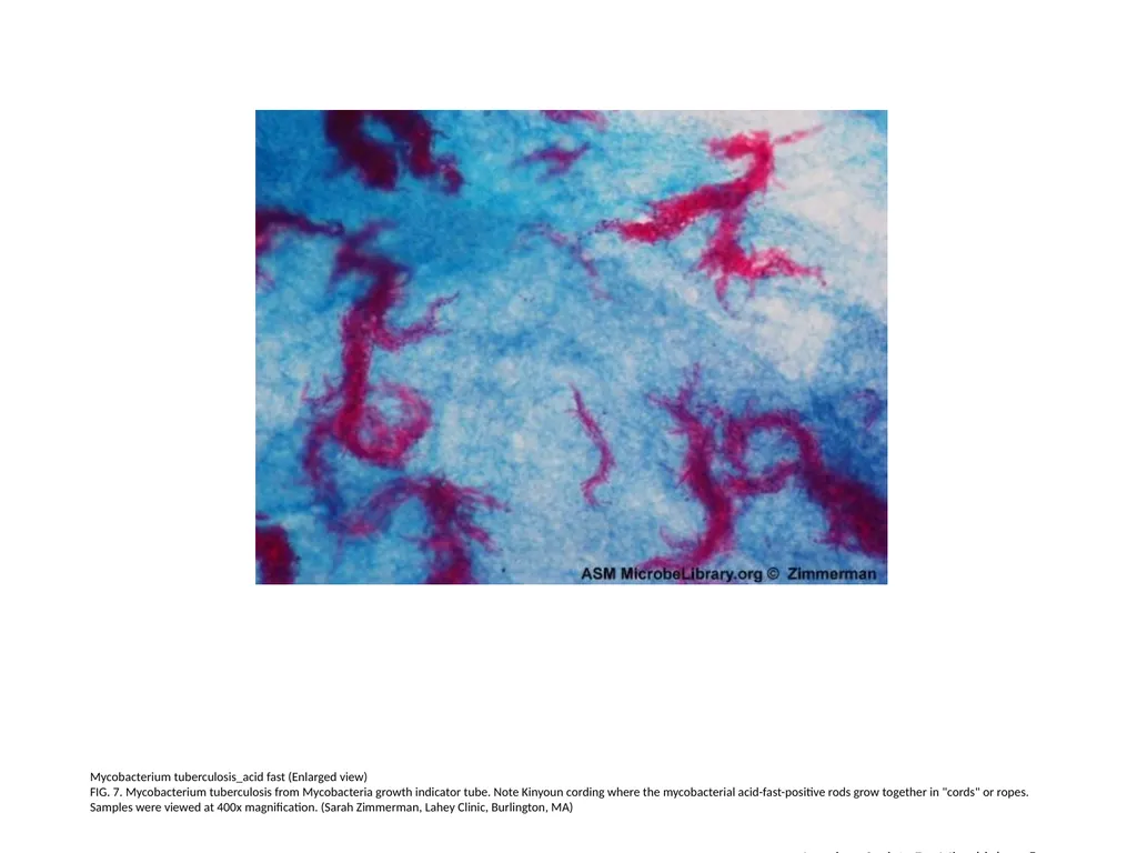 Acid-Fast Stain Author: Multiple Authors Citation: - slide 8 of 27