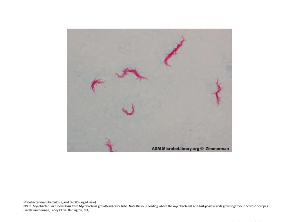Acid-Fast Stain Author: Multiple Authors Citation: - slide 9 of 27