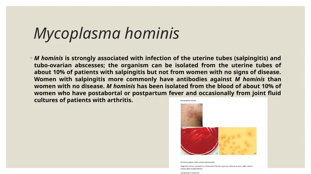 Medical Microbiology Asst. Prof. Dr. Dalya Basil - slide 15 of 21