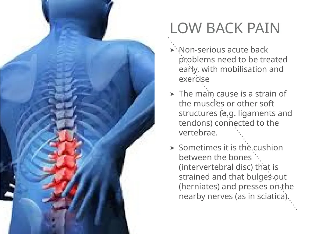 Mucoskeletal problems What you need to know Age - slide 10 of 26