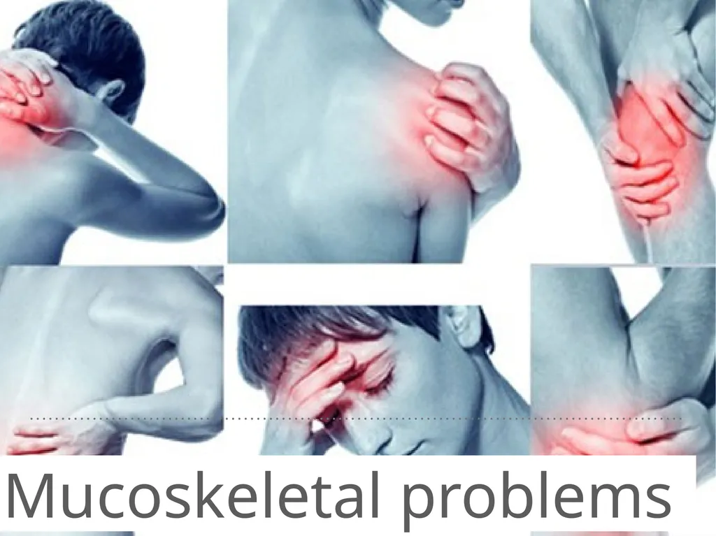 Mucoskeletal problems What you need to know Age - slide 1 of 26
