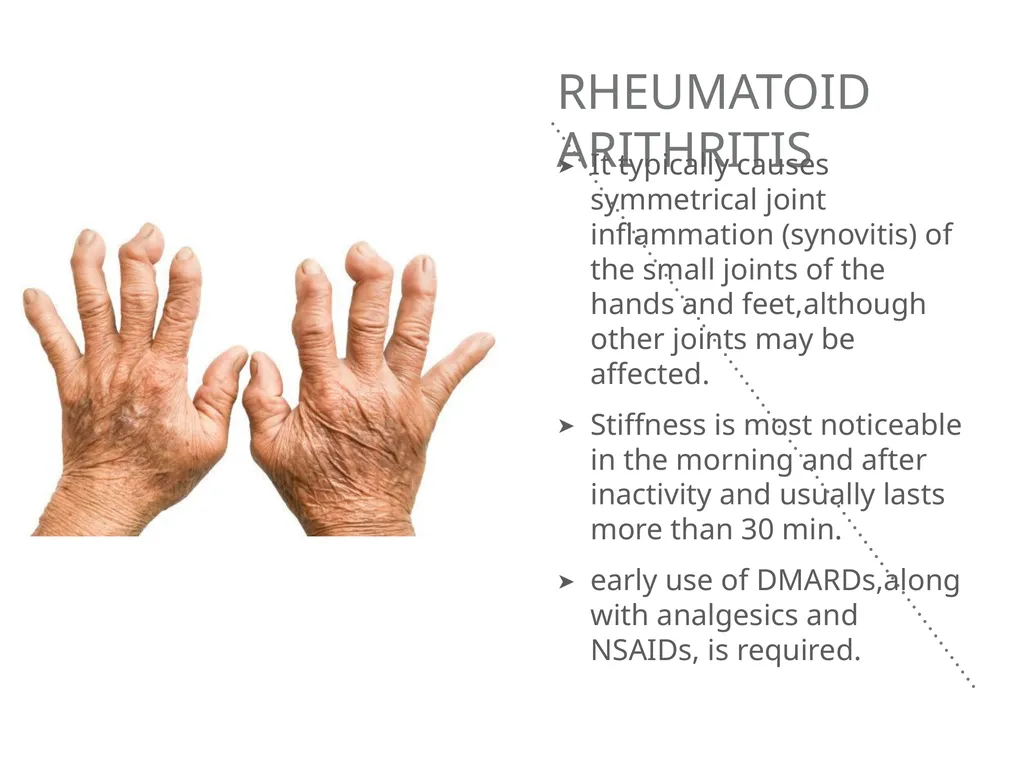 Mucoskeletal problems What you need to know Age - slide 9 of 26