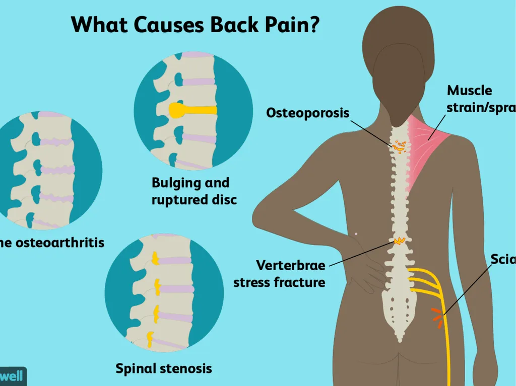 Mucoskeletal problems What you need to know Age - slide 11 of 26