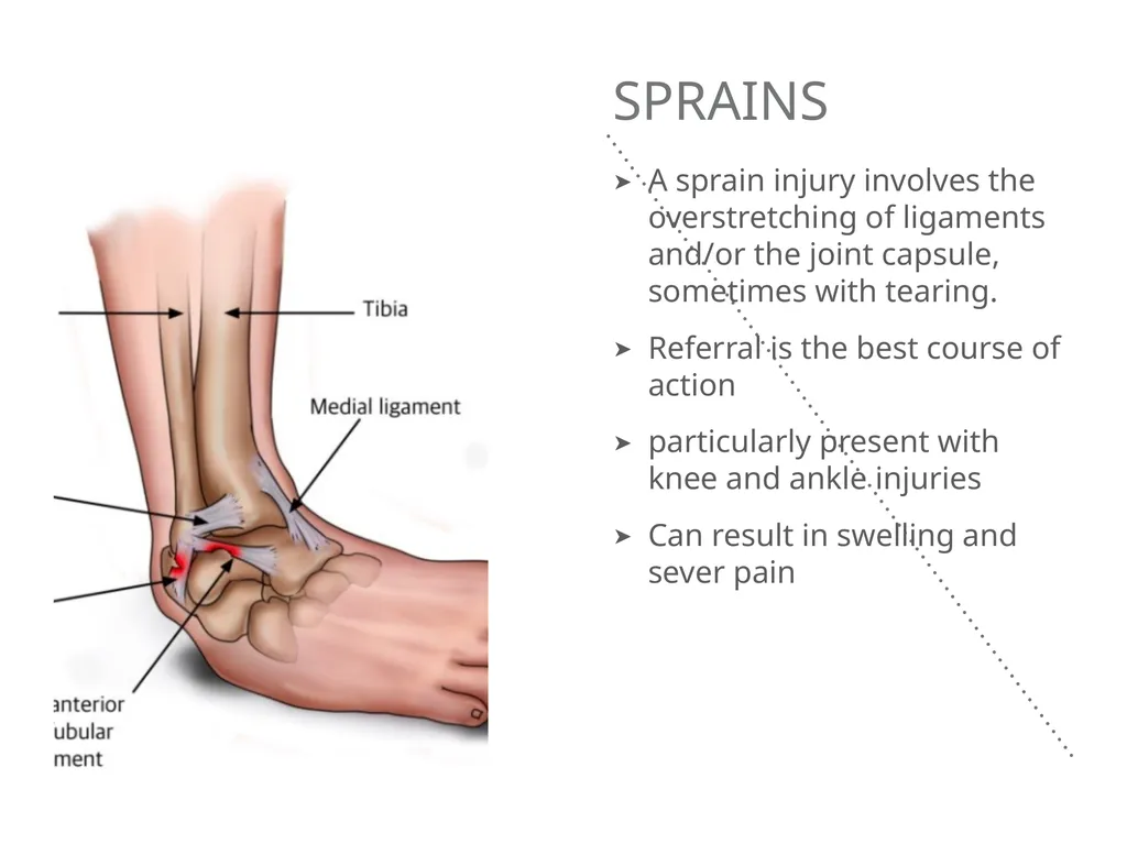Mucoskeletal problems What you need to know Age - slide 3 of 26