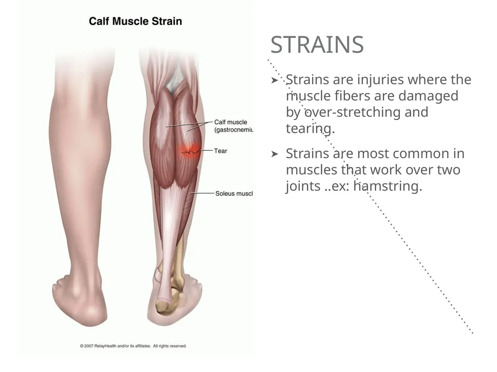Mucoskeletal problems What you need to know Age - slide 4 of 26