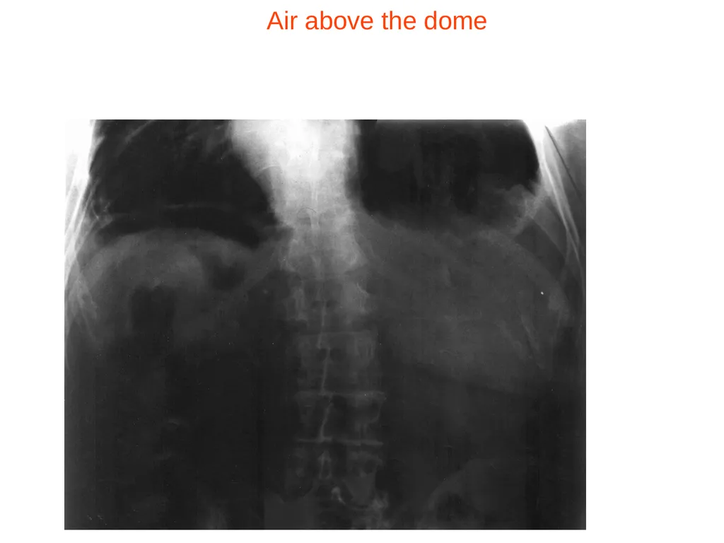 Digestive system diseases Małgorzata Dybich, MA - slide 14 of 59