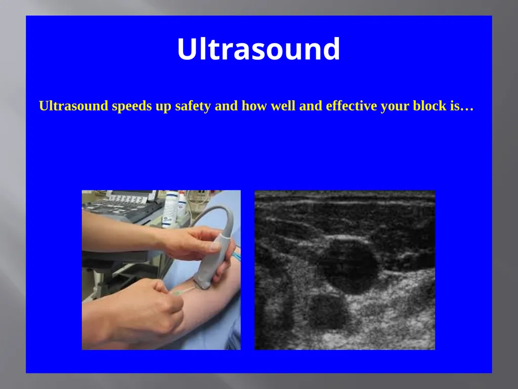 Local Anesthesia Systemic Toxicity LA(S)T - slide 6 of 27
