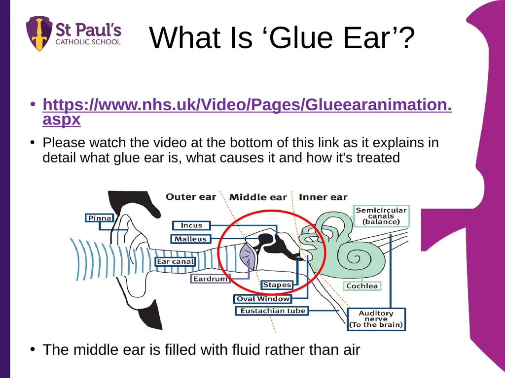 Supporting Children and Young People with Glue Ear - slide 3 of 15