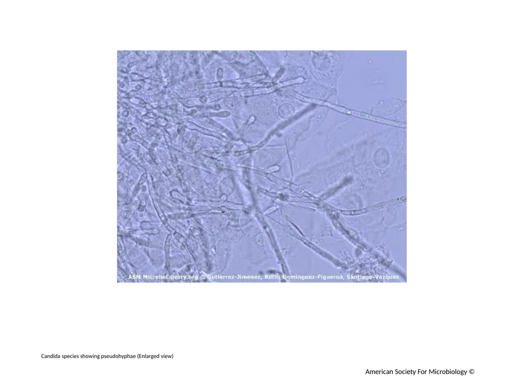 Candida spp. Showing Pseudohyphae in a Direct Wet - slide 3 of 4