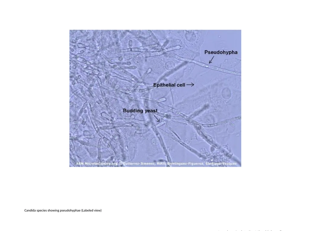Candida spp. Showing Pseudohyphae in a Direct Wet - slide 4 of 4