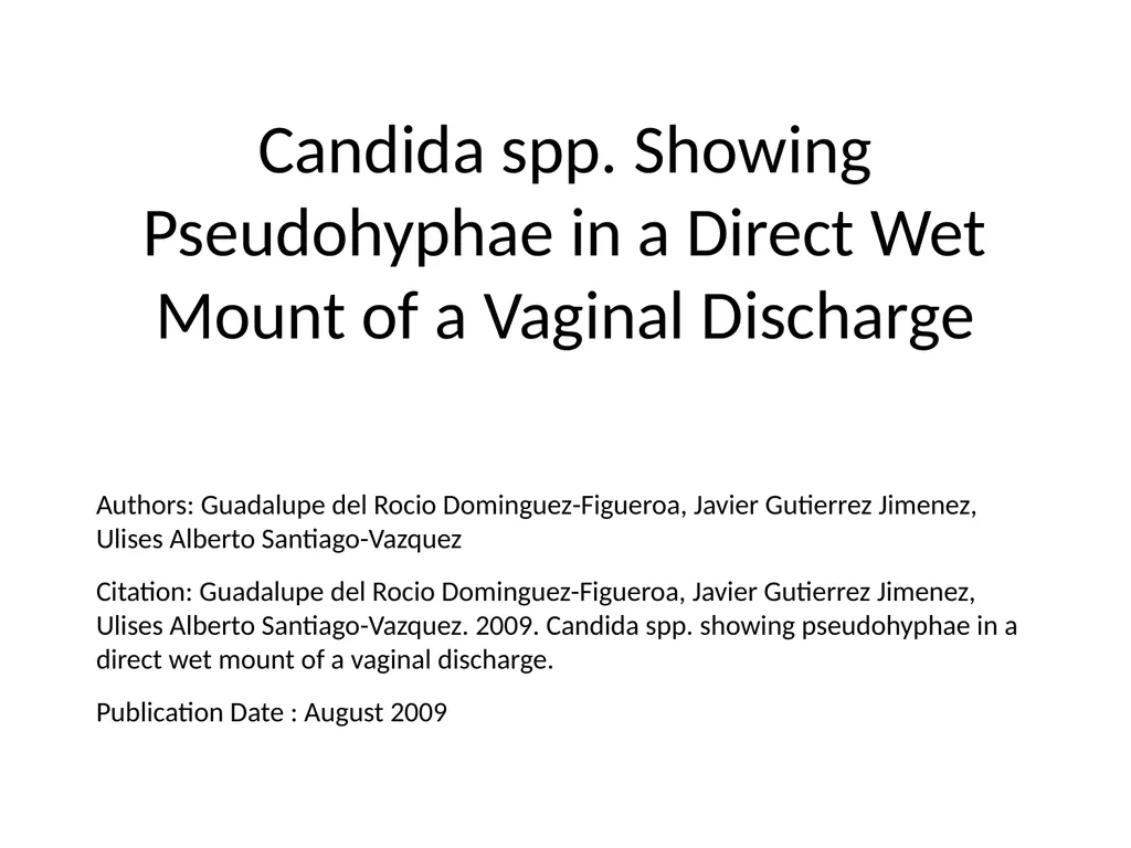 Candida spp. Showing Pseudohyphae in a Direct Wet - slide 1 of 4