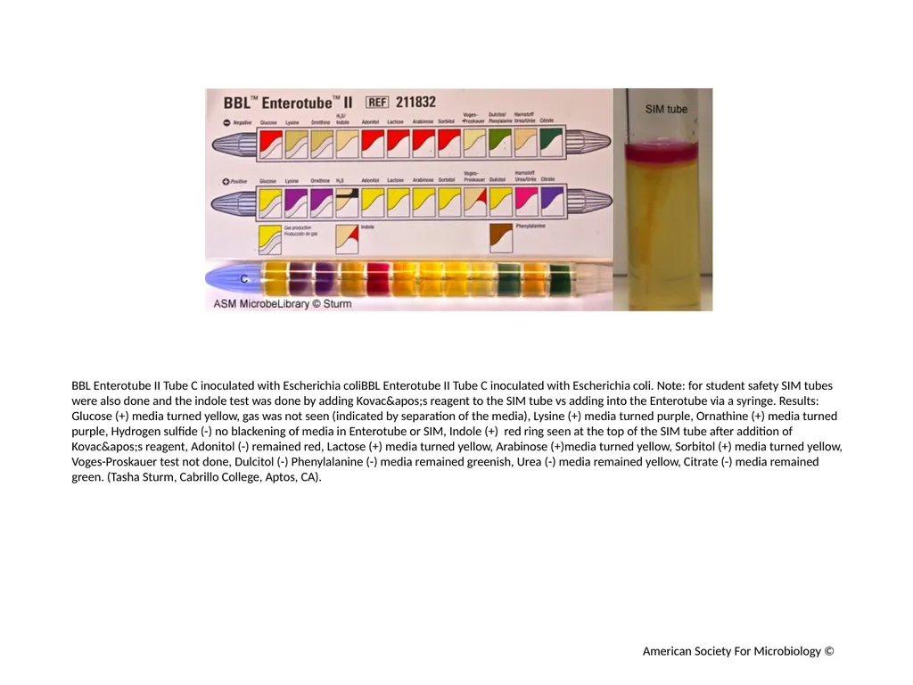 BBL Enterotube II Author: Multiple Authors - slide 7 of 10